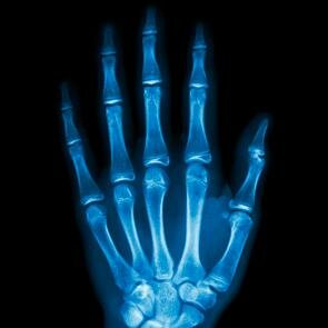 Descubrimiento Rayos X