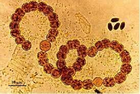 Teoría microbiana sin Pasteur y koch