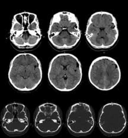 Imágenes no anatómicas