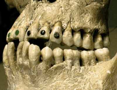 Mutilación dental azteca