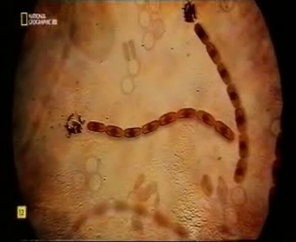 LA TEORÍA MICROBIANA