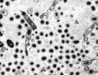 La teoría microbiana