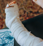 Broken legs and Broken hearts