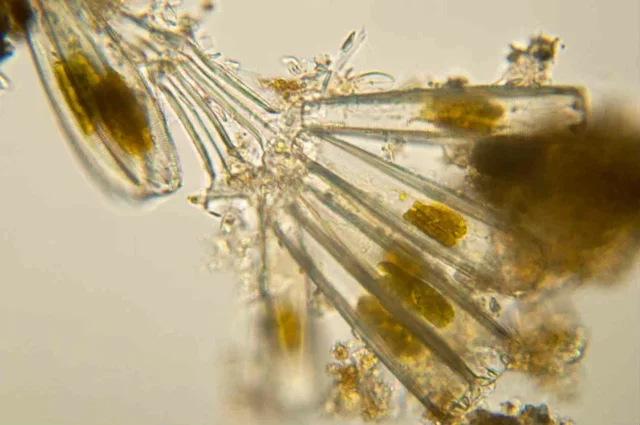 The invention of staining