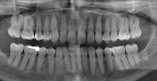 Start of use of dental records to identify victims