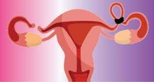 Aceptación de la Salpingoclasia.