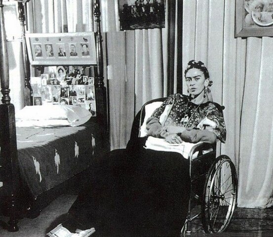 In 1953, her right leg was amputated.