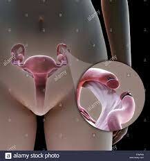 Técnica quirurgica anticonceptiva