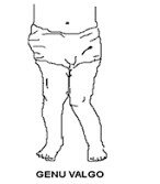 El recién nacido/ infancia (0-3 años aproximadamente) Ejercicio sugerido 2: Recién nacido