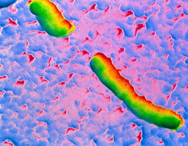 Bacteria Haemophilus influenzae