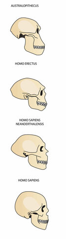 Aumento de la capacidad craneal