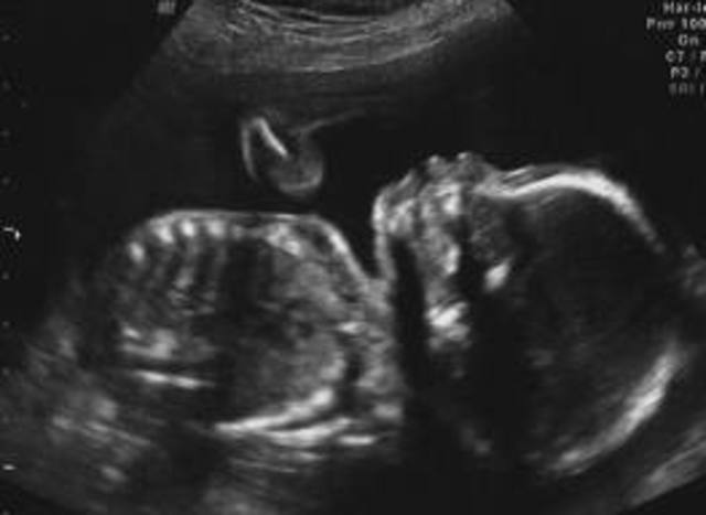 Kicking for the first time