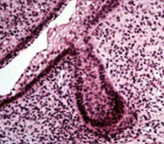 Etapa de botón o yema