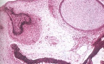 Etapa de casquete​