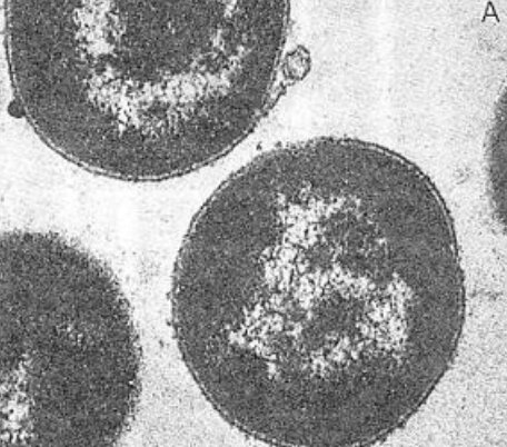 Primera cèl·lula eucariota