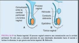 Descenso ovárico 12 semanas