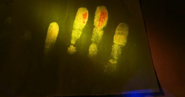 Alternate Light Photography