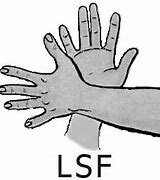 Le réveil des sourds