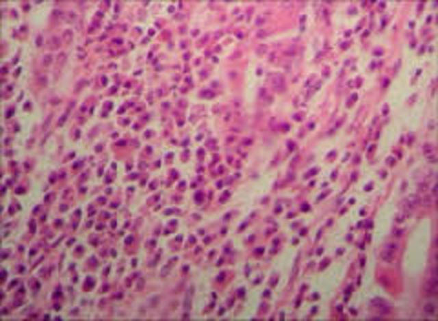 1847 Henri Dutrochet