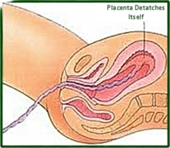 The woman gives birth to the placenta, no longer needed by the baby.