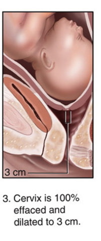 First Stage of Labor