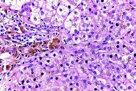 Partículas hereditarias