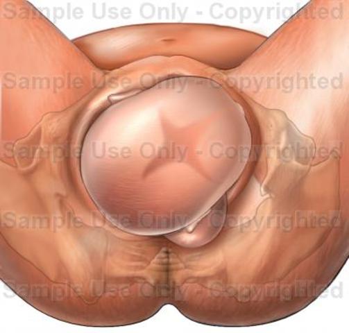 The top of the head appears at the opening of the birth canal.
