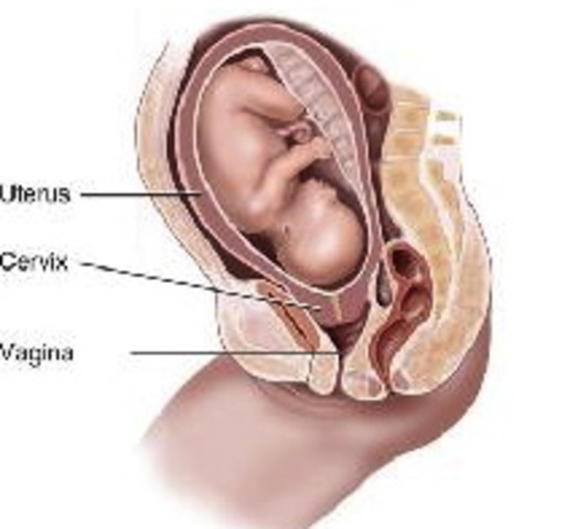 This is called EFFACEMENT