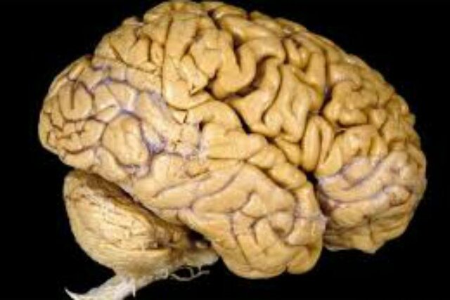 Ver dentro del cerebro