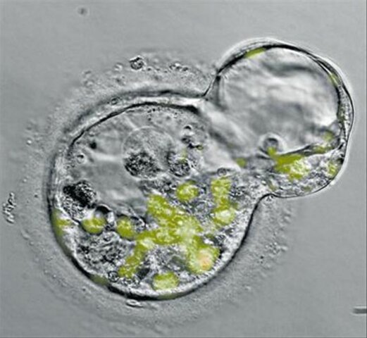 Clonacion de la Insulina