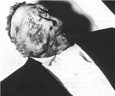 Murder of Emmett Till