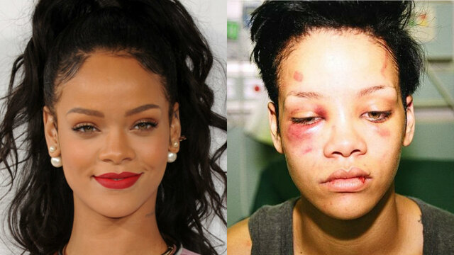 Rihanna Is Attacked By Her Boyfriend