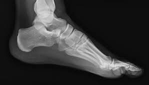 Gammagrafias, radiografias!?