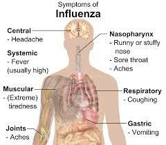 Influenza