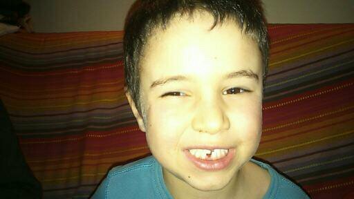 EM CAU LA PRIMERA DENT!!!