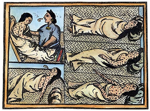 Smallpox [15th century] America
