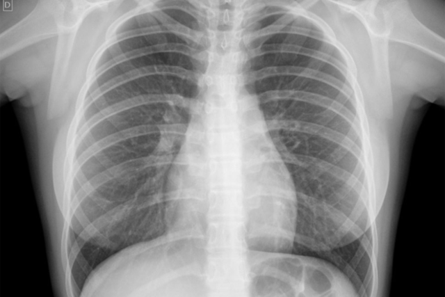 A morte de Pierre e a vida de Curie após essa tragédia.