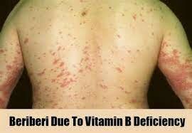 Línea del tiempo de la nutrición