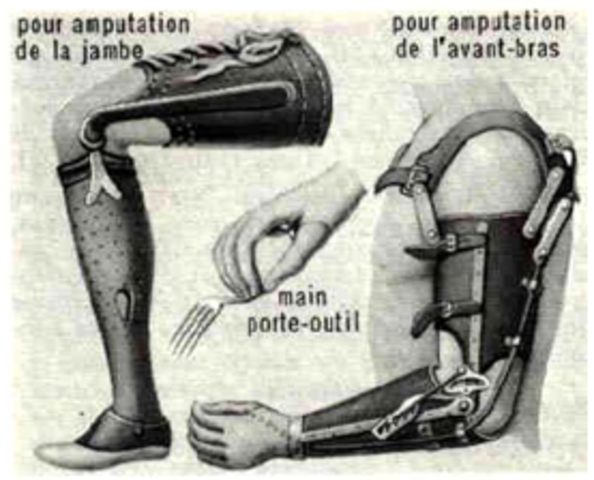 Prótesis movilizada por el tronco y el hombro