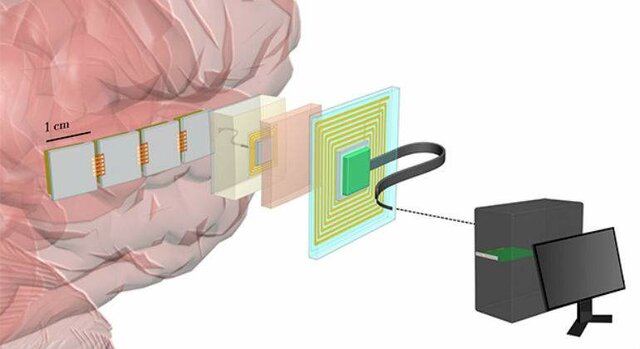 Protesis chip neuronal