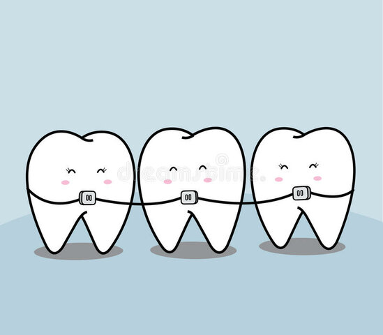 Got Braces