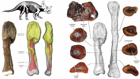 Primeras Enfermedades Ocupacionales