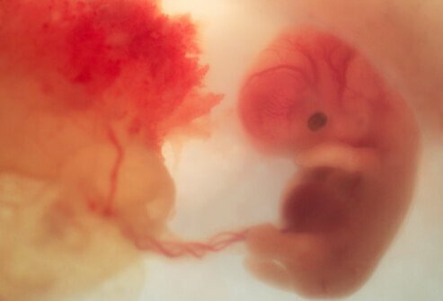 Development at 4 Weeks