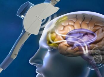 Estimulación Magnética transcraneal