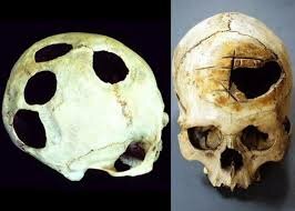 Siglo V a.C. - Hipócrates