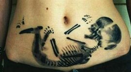 Timeline: History of Medical Abortions