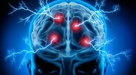 Timeline: La Neuropsicologia en el Tiempo