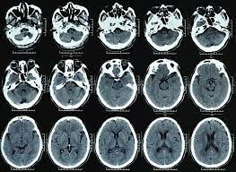 DURANTE LA DECADA DE 1990