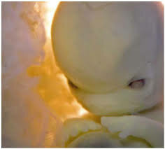 DESARROLLO DE LA CABEZA Y CARA. 4TA SEMANA