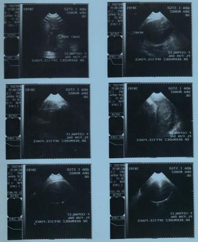 MY MOM'S ULTRASOUND